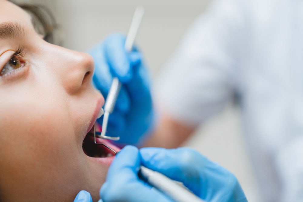 Close,Up,Cropped,Photo,Of,Curing,Healing,Operating,Teeth,Tooth,