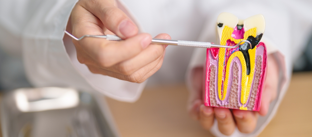 Dentist,With,Tooth,Anatomy,Model.,Oral,Teeth,Decay,And,Disease,