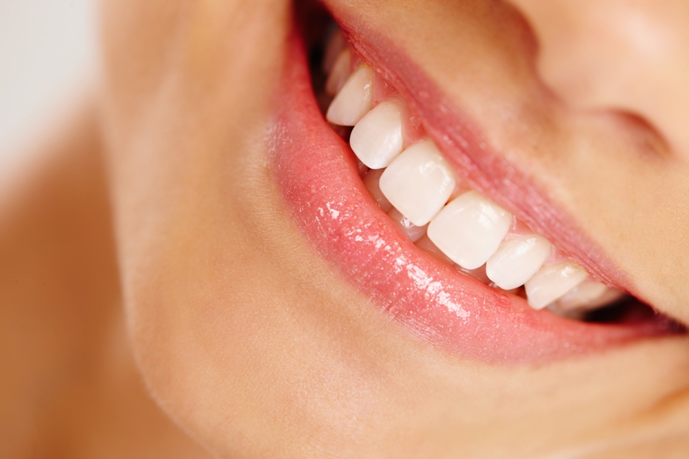 Woman,,Mouth,And,Oral,Care,Smile,In,Closeup,,Orthodontics,And