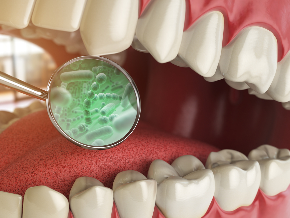 Bacterias,And,Viruses,Around,Tooth.,Dental,Hygiene,Medical,Concept.,3d