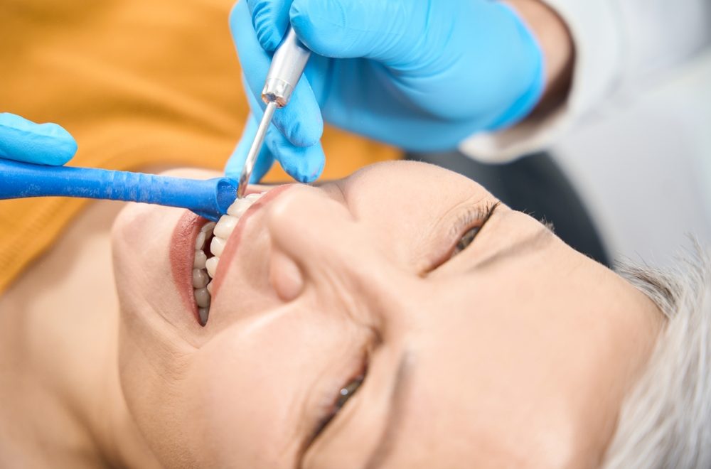 Close-up,Mature,Lady,Smiling,Visiting,Aesthetic,Dentist,,Airflow,Tooth,Cleaning