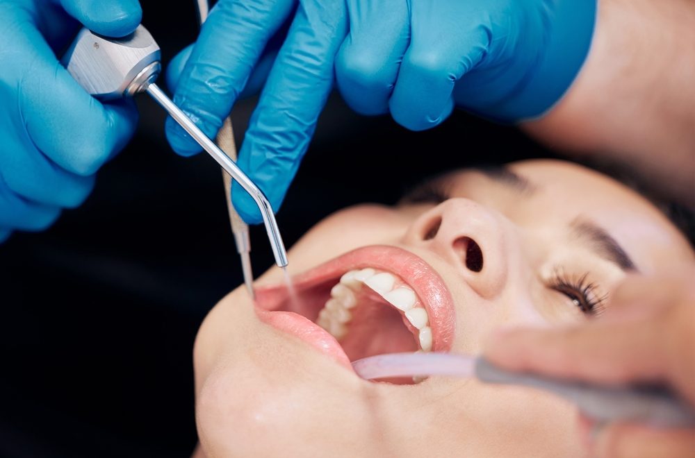 Dental,,Mouth,And,Woman,Consutling,Dentist,For,Teeth,Whitening,,Wellness