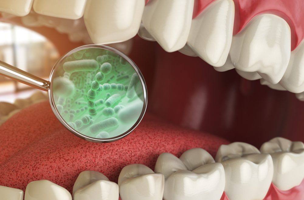 Bacterias,And,Viruses,Around,Tooth.,Dental,Hygiene,Medical,Concept.,3d